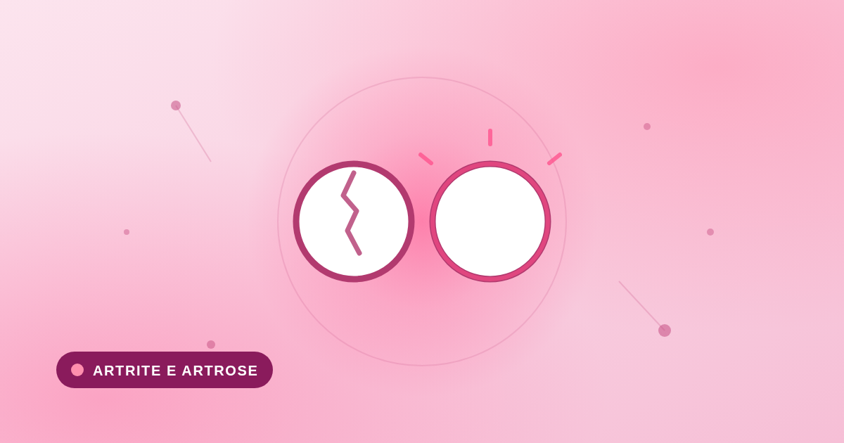 Ilustração comparando duas articulações: artrite e artrose